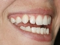 Konig Center for Cosmetic & Comprehensive Dentistry smile photos